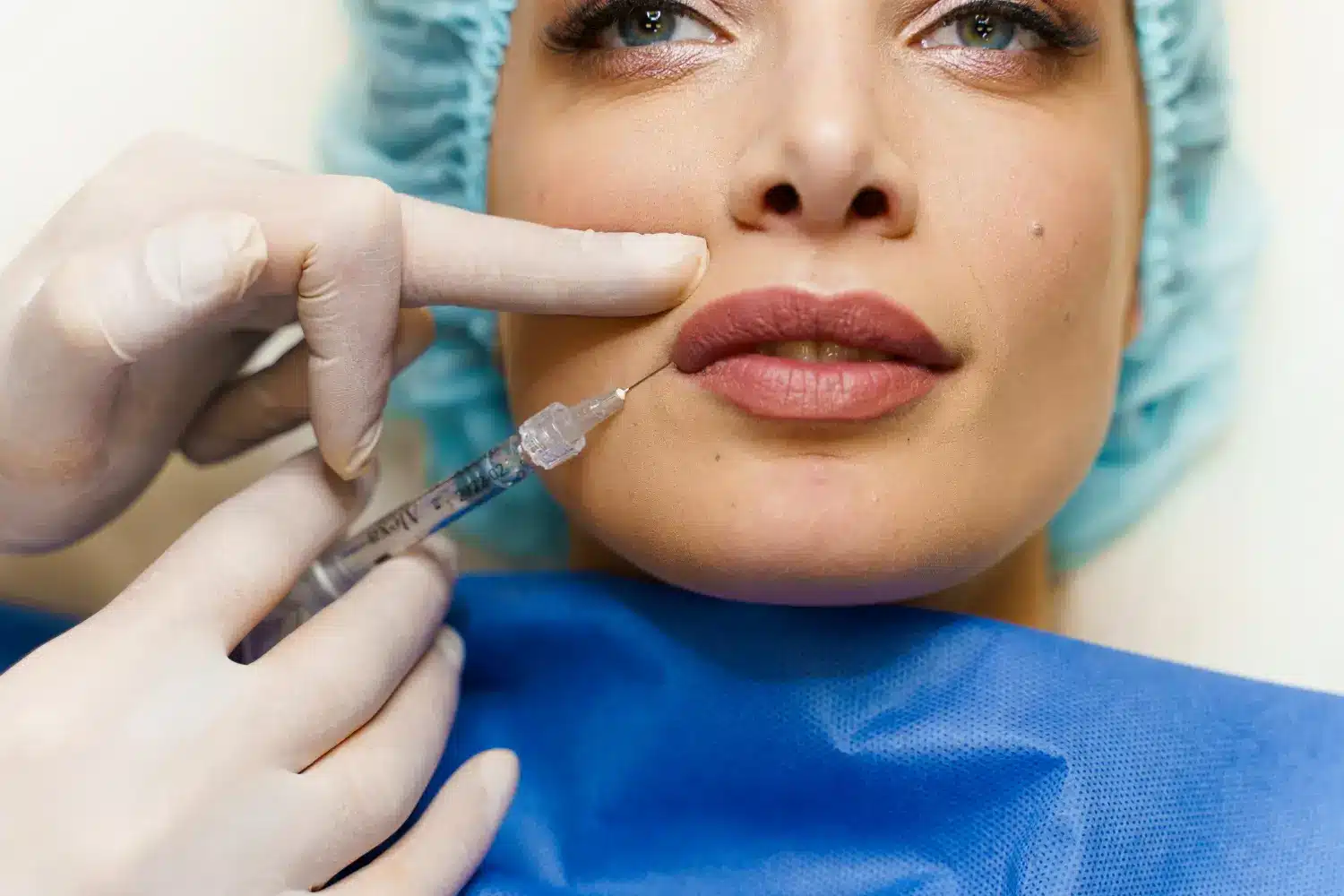 Bellast vs PLLA Fillers | 3 Key Differences