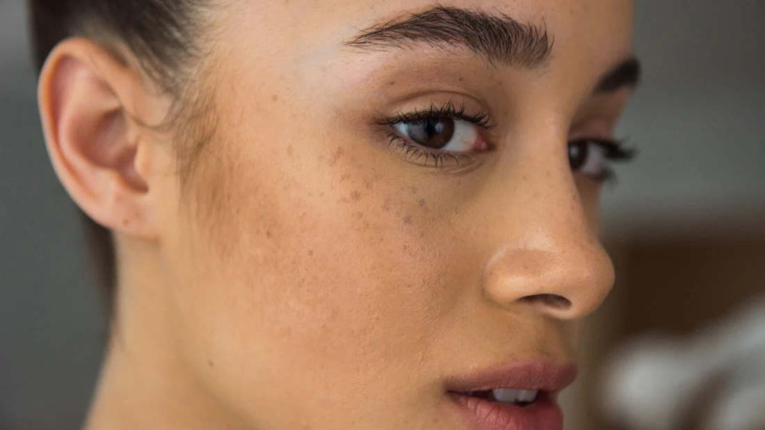 DeneB Classic H for Dark Spots 5 Real Results in 4 Weeks